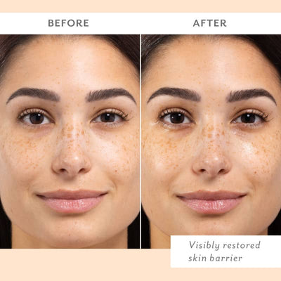 Skin Remedy Calm & Protect Mist