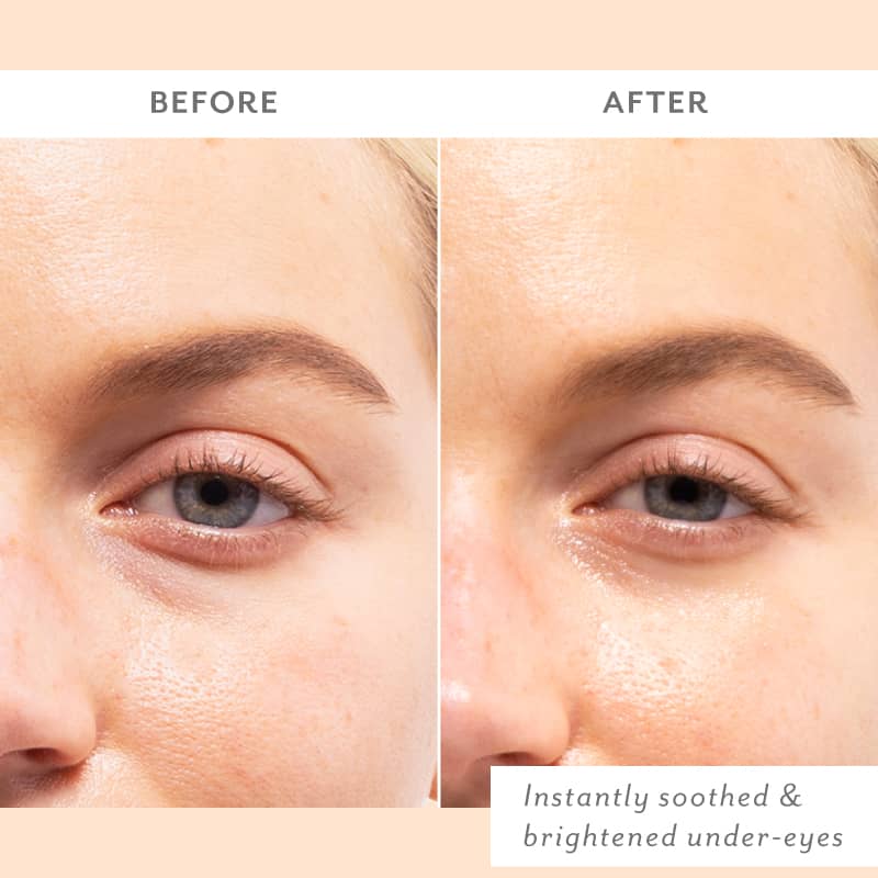 Skin Remedy Soothing Eye Gels - Single