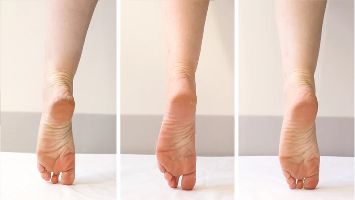 Poshpeel Pedi Cure